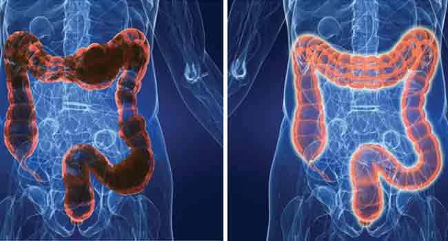 How much water is used in colon hydrotherapy?