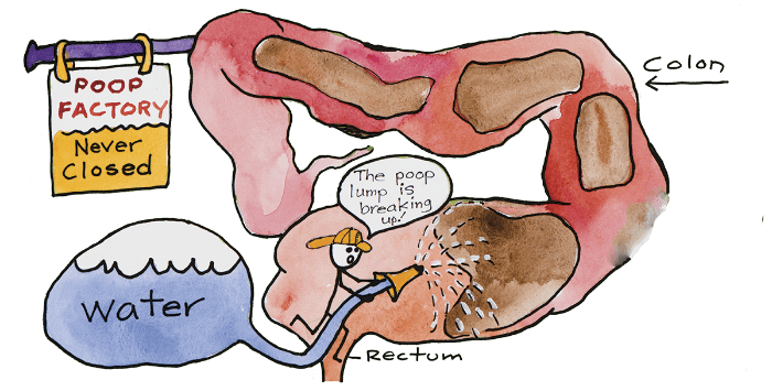 What Happens During Colonic Hydrotherapy?